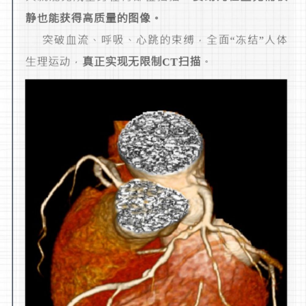 智慧诊疗，影像先行——曹县磐石医院开创CT安全筛查新时代