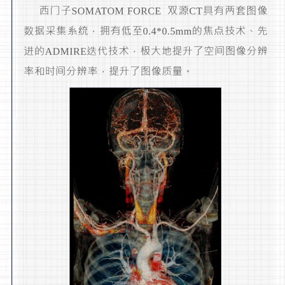 智慧诊疗，影像先行——曹县磐石医院开创CT安全筛查新时代