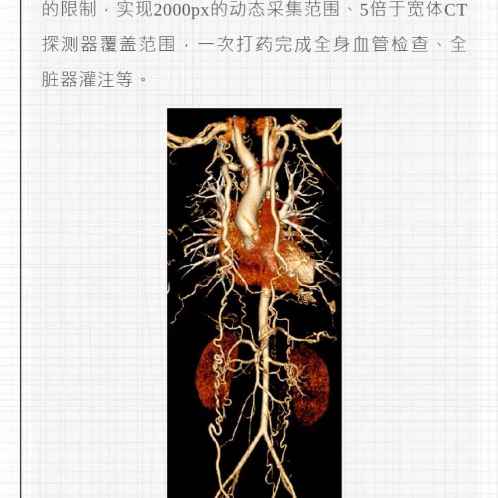 智慧诊疗，影像先行——曹县磐石医院开创CT安全筛查新时代